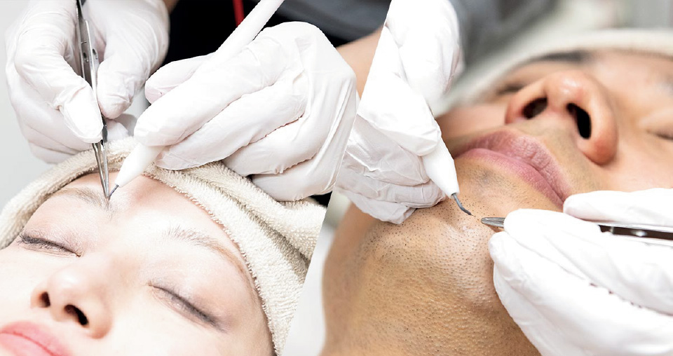 ジェントルマックスプロプラス