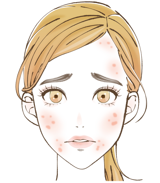 マッサージピール