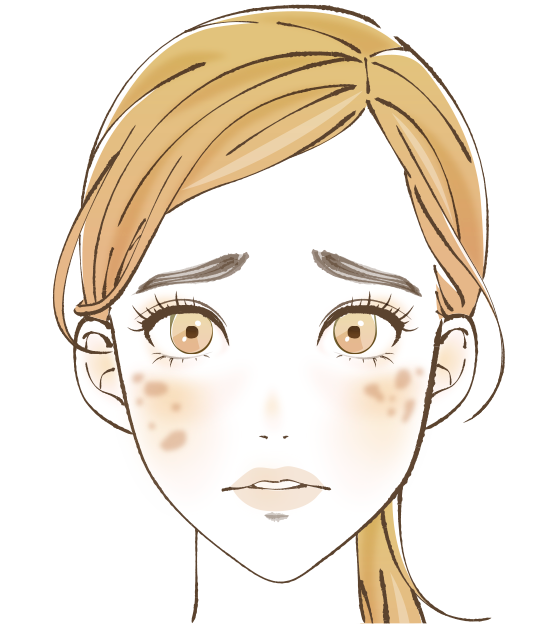 レーザーフェイシャル