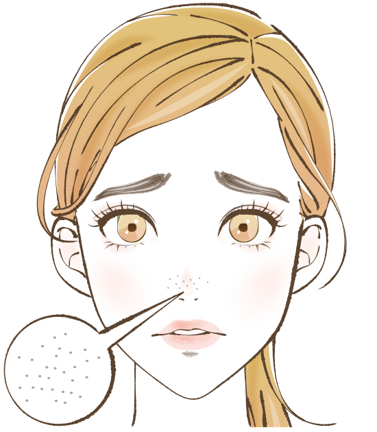 レーザーフェイシャル