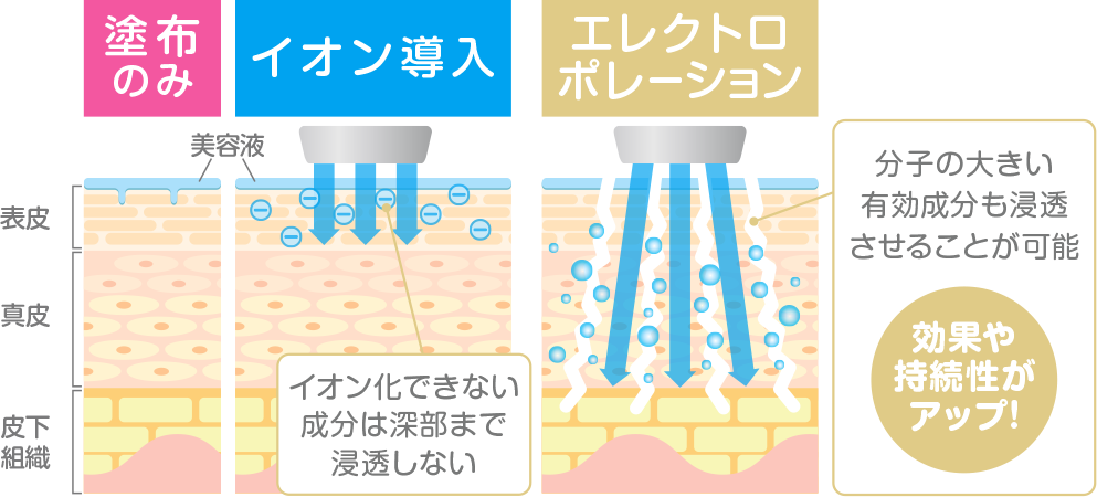 エレクトロポレーション