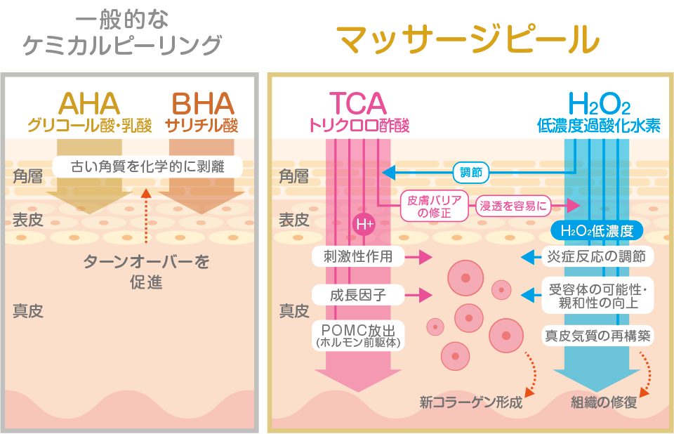 マッサージピール
