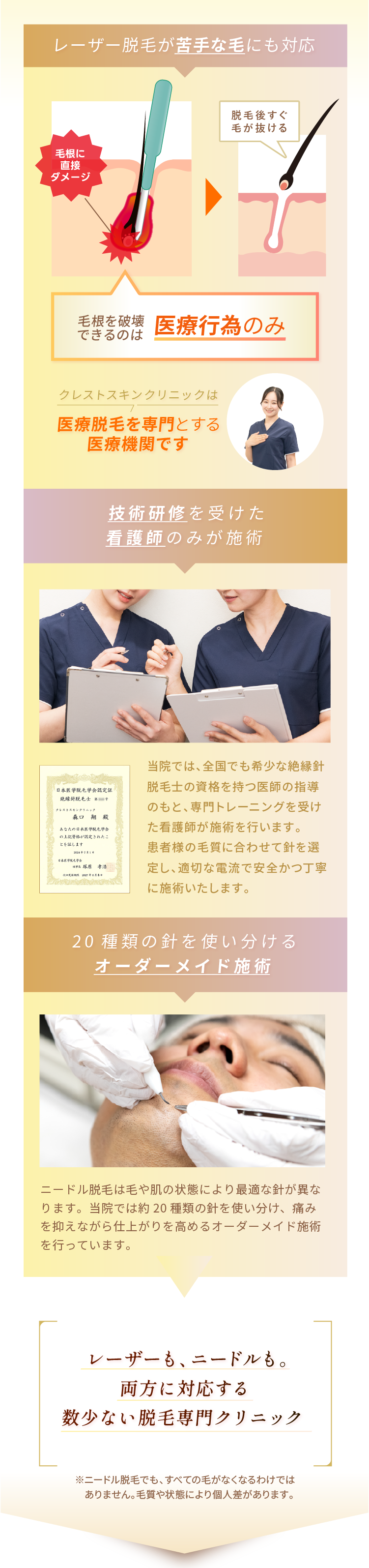 レーザー脱毛が苦手な毛にも対応 全国でも希少な資格を持った看護師のみが施術 20種類の針を使い分けるオーダーメイド施術