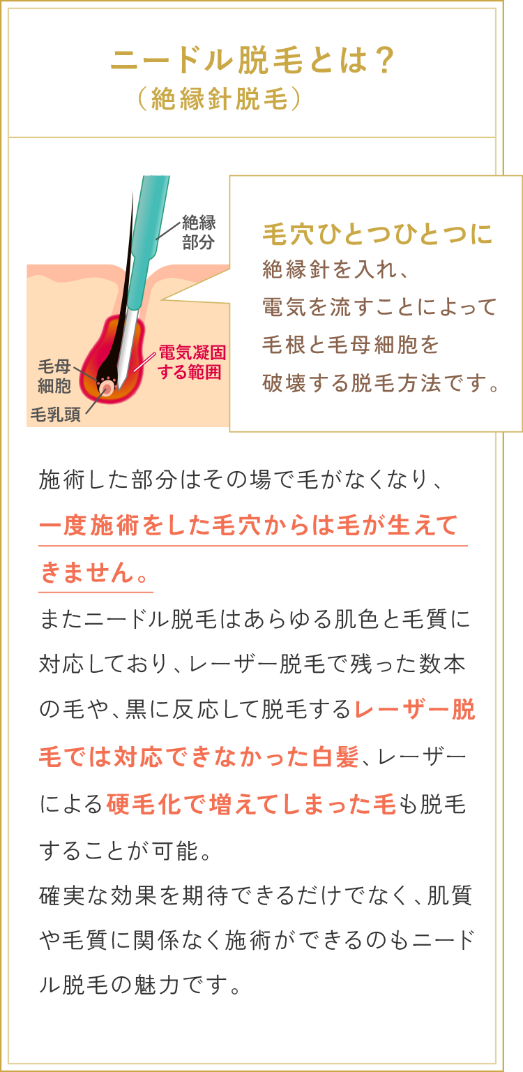 ニードル脱毛とは？