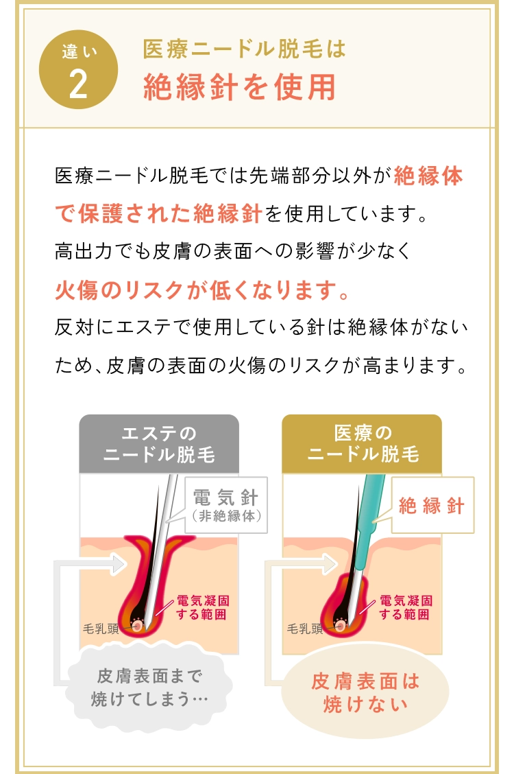 絶縁針を使用