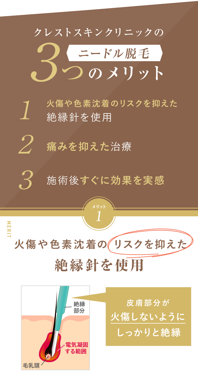 火傷や色素沈着のリスクを抑えた絶縁針を使用