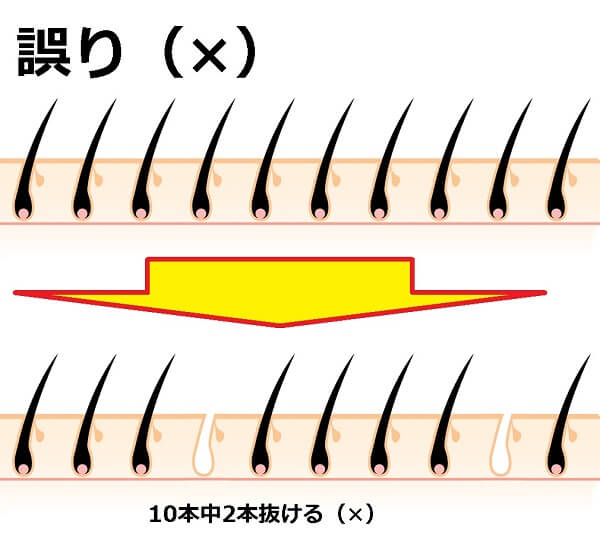 脱毛効果の誤り